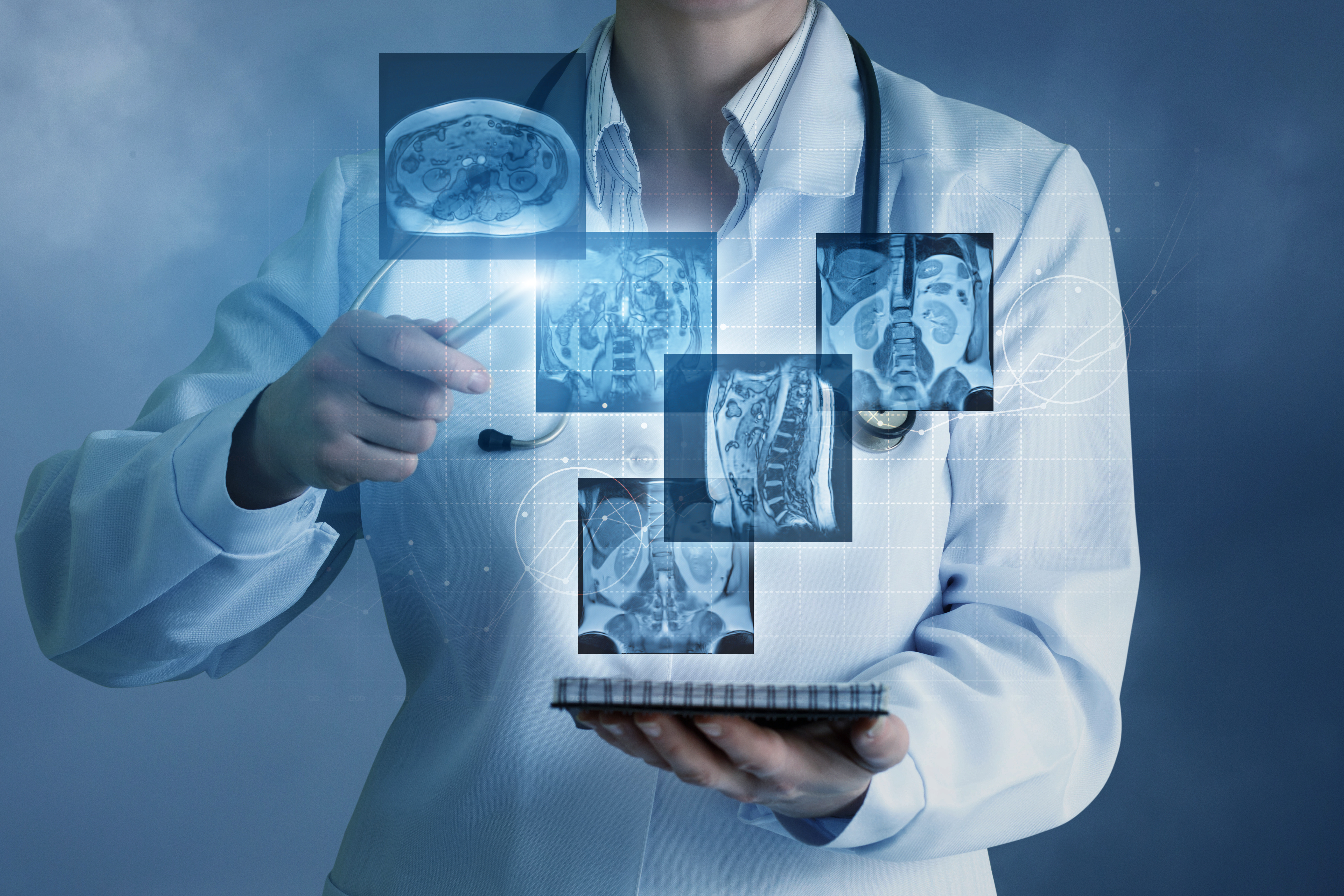 Floating radiology scans in front of a doctor