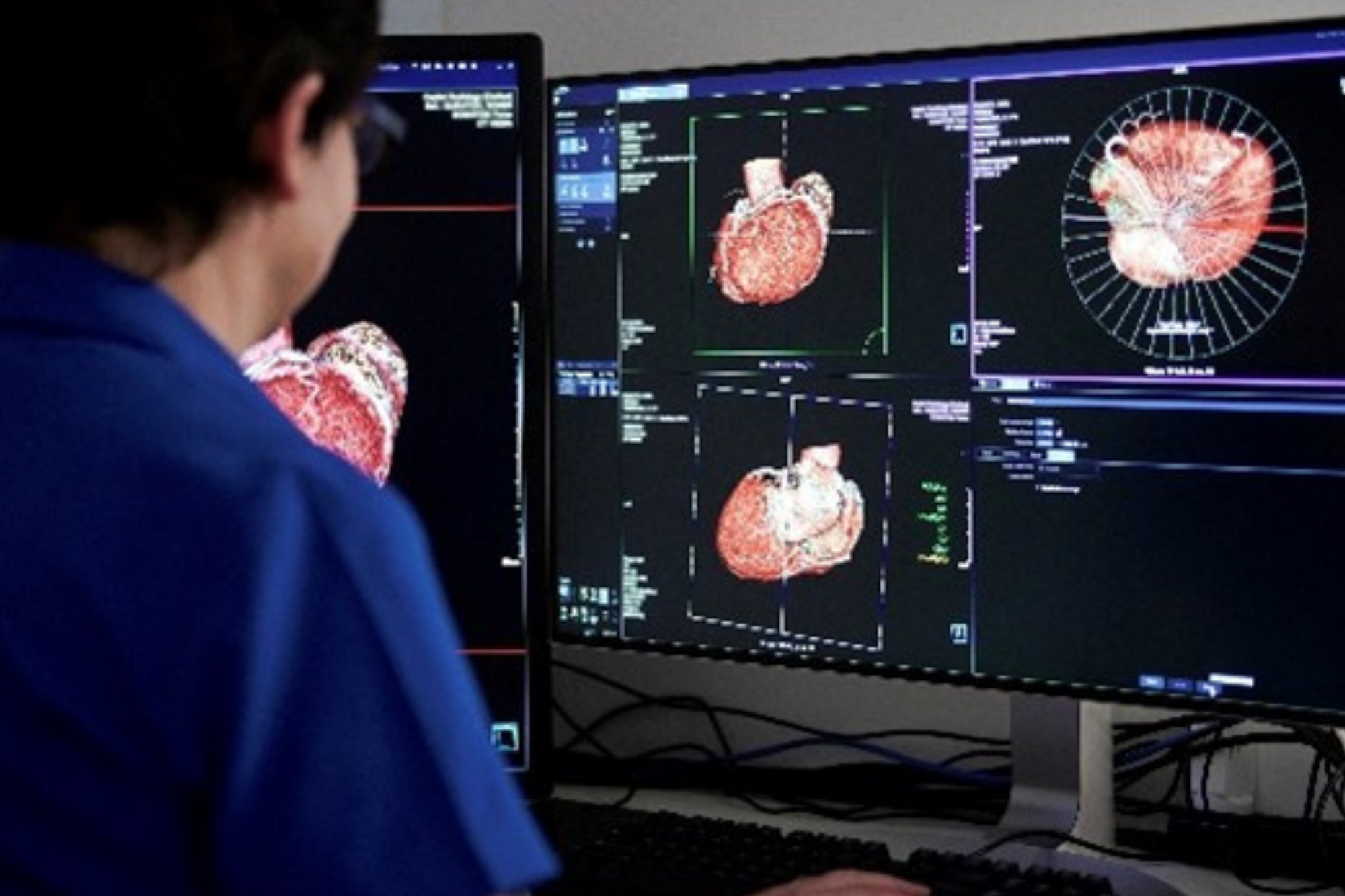 Female Doctor Examining Patient's X ray Results | Australia Radiology Clinic | Capital Radiology