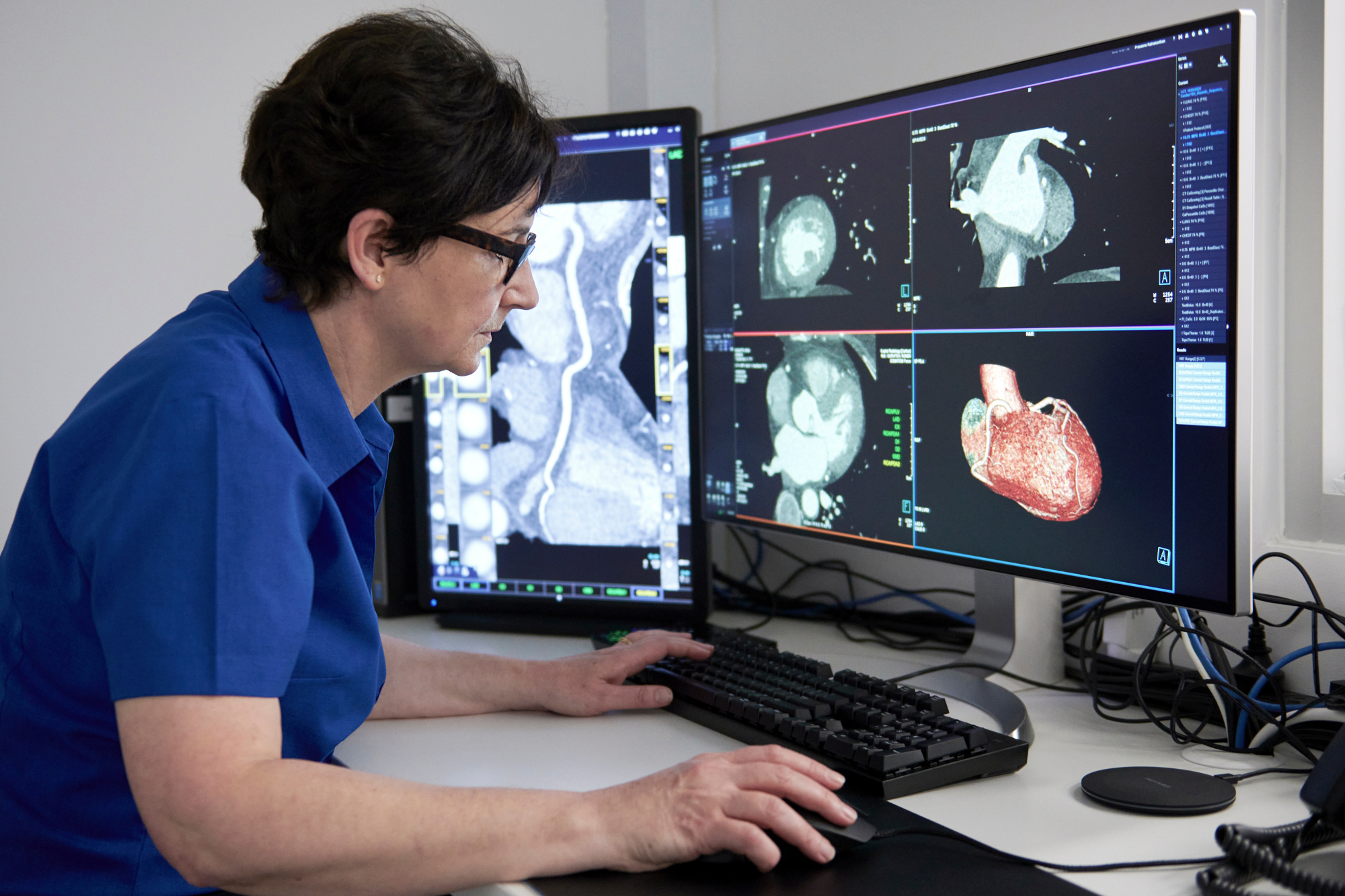 X rays Being Examined by Female Doctor on Computer Screen | BMD Dexa Test | Capital Radiology