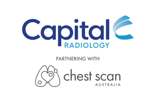 National Lung Cancer Screening Program